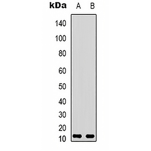 VIP Rabbit Polyclonal Antibody