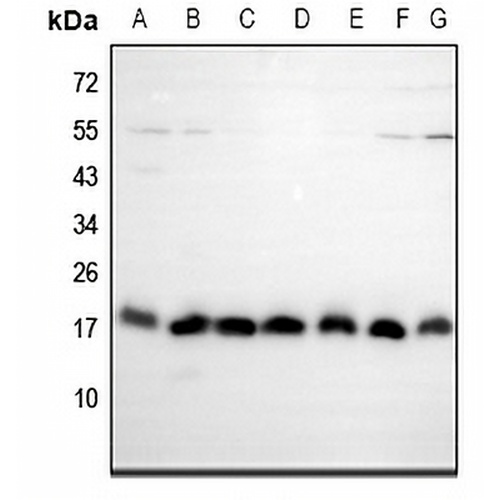 EIF5A2 Rabbit Polyclonal Antibody