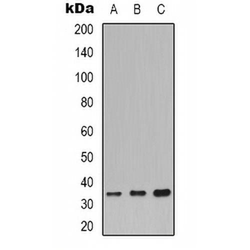 CDC34 Rabbit Polyclonal Antibody