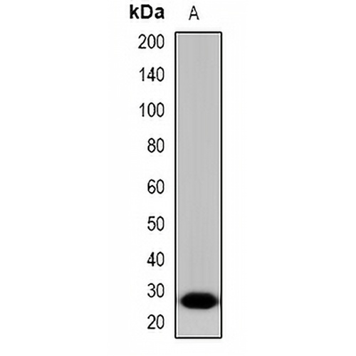 LAT Rabbit Polyclonal Antibody