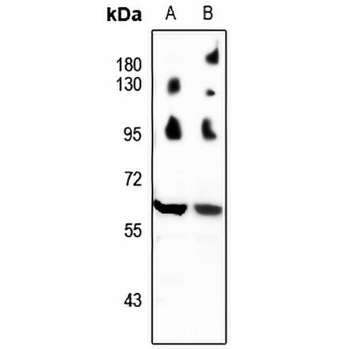 Beclin-1 Rabbit Polyclonal Antibody