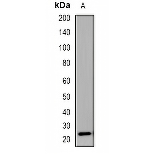 SEC22B Rabbit Polyclonal Antibody