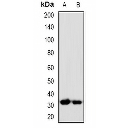 PP5 Rabbit Polyclonal Antibody