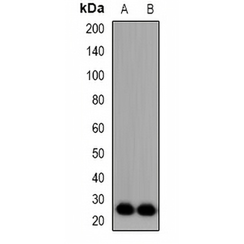 FGF11 Rabbit Polyclonal Antibody