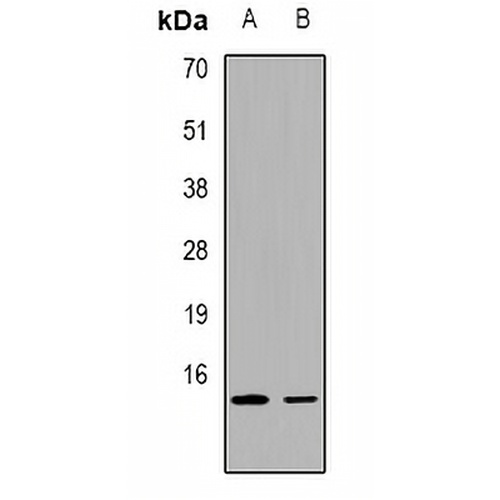 FABP2 Rabbit Polyclonal Antibody