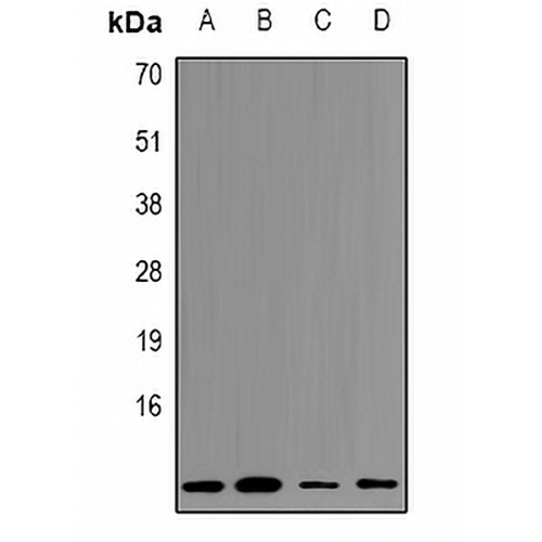 Cystatin A Rabbit Polyclonal Antibody