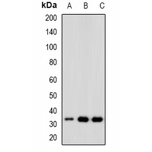 CDK6 Rabbit Polyclonal Antibody