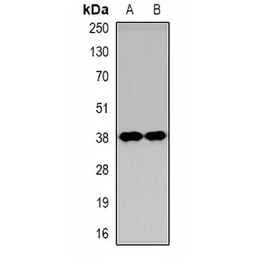 KIM1 Rabbit Polyclonal Antibody