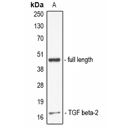TGF beta 2 Rabbit Polyclonal Antibody