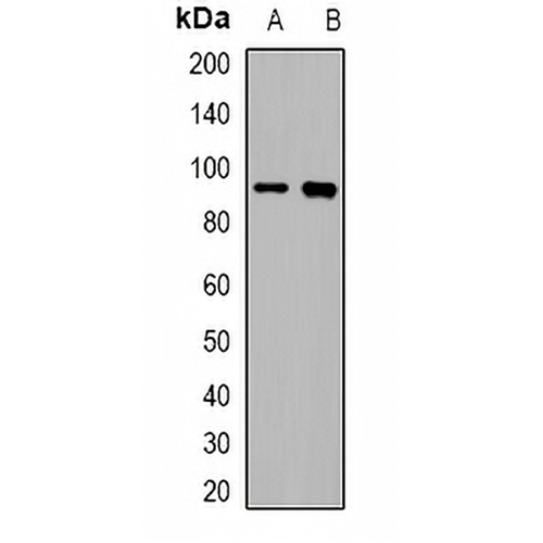 Villin Rabbit Polyclonal Antibody