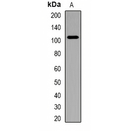 Catenin delta 1 Rabbit Polyclonal Antibody