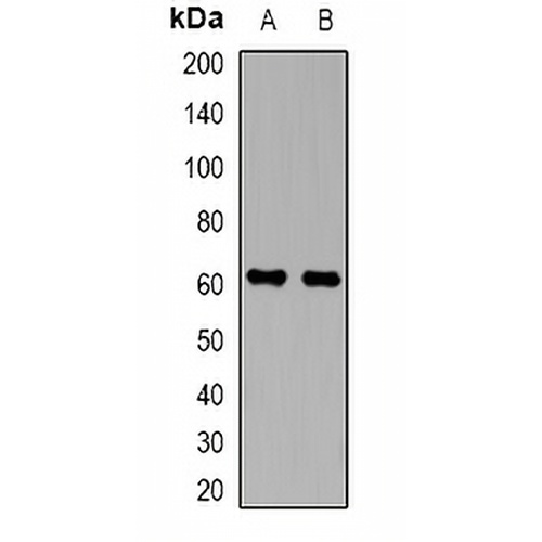 Perforin 1 Rabbit Polyclonal Antibody