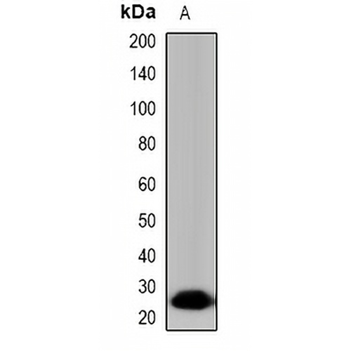 Tryptase delta Rabbit Polyclonal Antibody