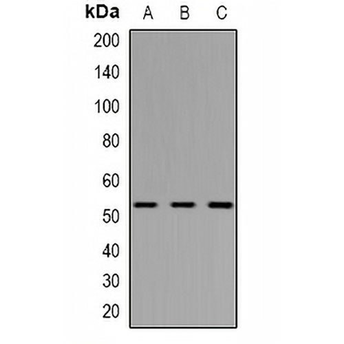 Vimentin Rabbit Polyclonal Antibody