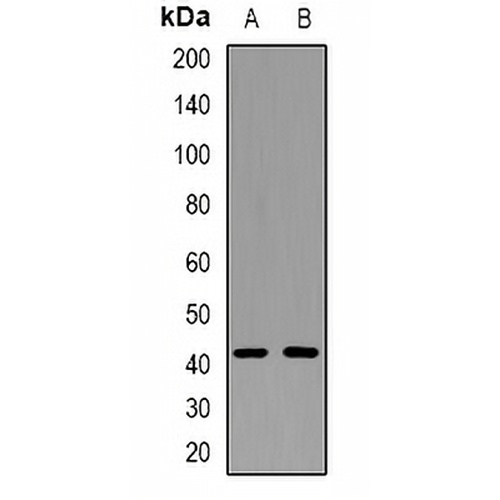 Smooth Muscle Actin Rabbit Polyclonal Antibody
