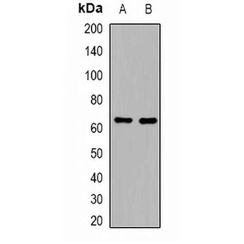 Complement C8 beta Rabbit Polyclonal Antibody