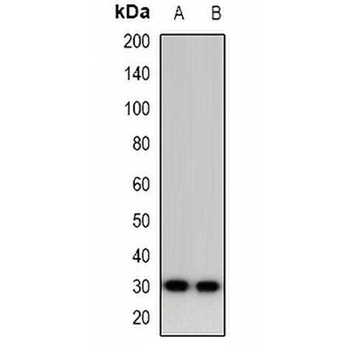 Calsarcin 1 Rabbit Polyclonal Antibody