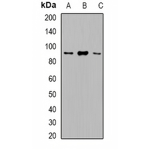 VPS35 Rabbit Polyclonal Antibody