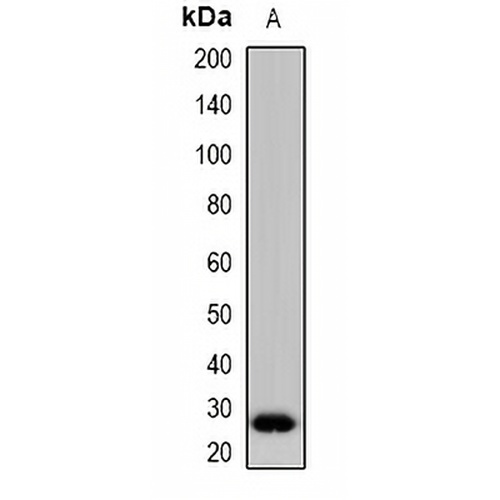 DCIR Rabbit Polyclonal Antibody