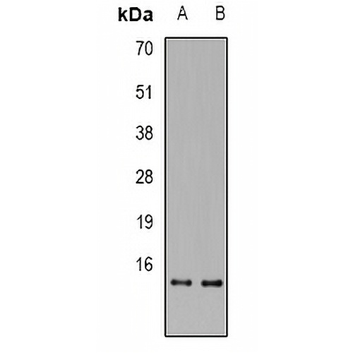 RPA3 Rabbit Polyclonal Antibody