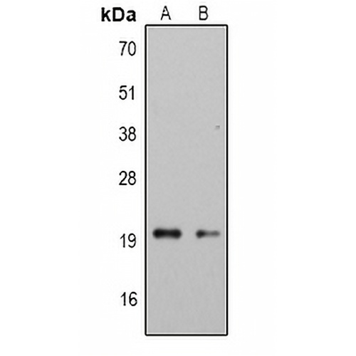 CMTM6 Rabbit Polyclonal Antibody