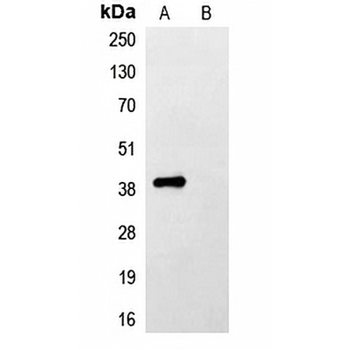 FLAG-tag Rabbit Polyclonal Antibody