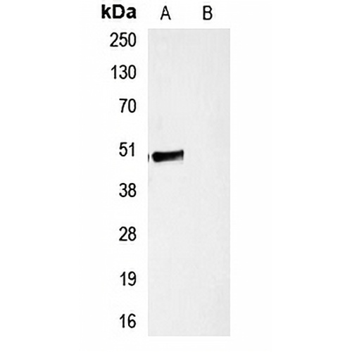 HA-tag Rabbit Polyclonal Antibody