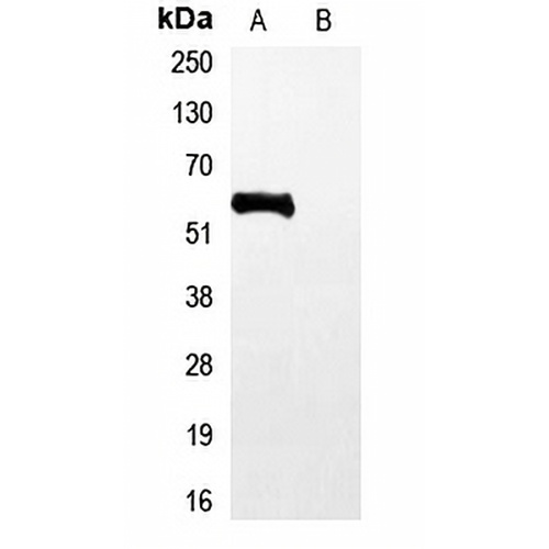 His-tag Rabbit Polyclonal Antibody