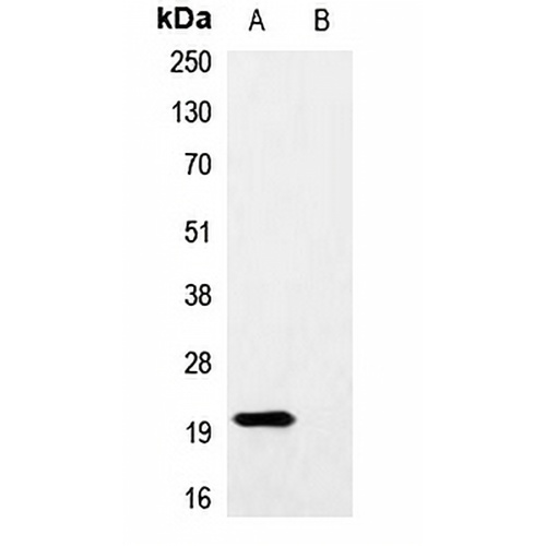 Myc-tag Rabbit Polyclonal Antibody
