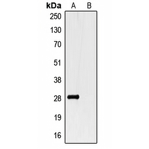 GST-tag Rabbit Polyclonal Antibody