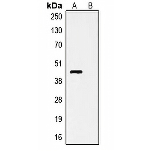 V5-tag Rabbit Polyclonal Antibody