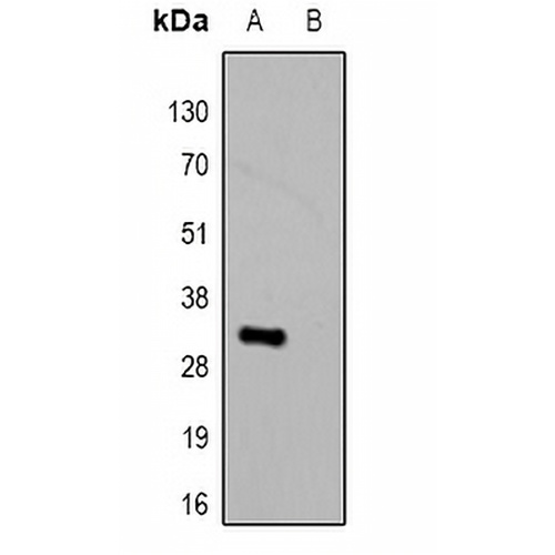 HSV-tag Rabbit Polyclonal Antibody
