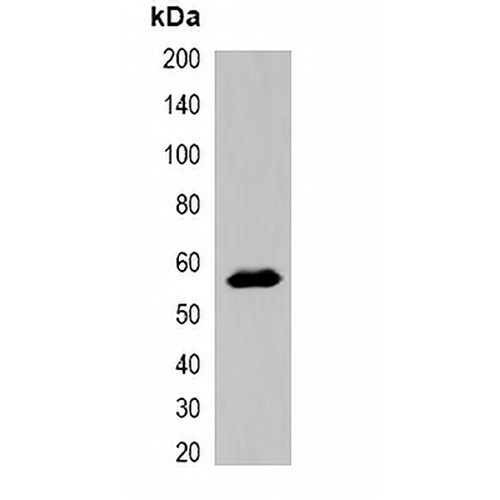 MBP-tag Rabbit Polyclonal Antibody