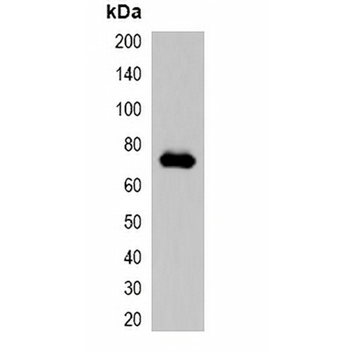 mCherry-tag Rabbit Polyclonal Antibody