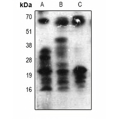 Acetyl Lysine Rabbit Polyclonal Antibody