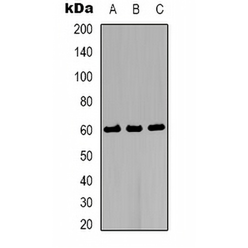 AKT2 Rabbit Polyclonal Antibody