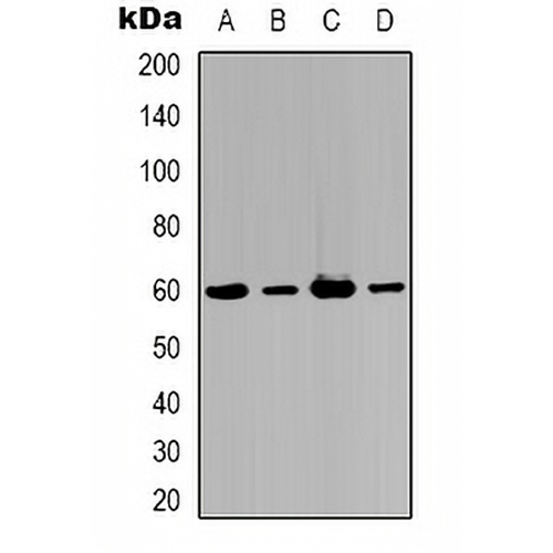AKT3 Rabbit Polyclonal Antibody