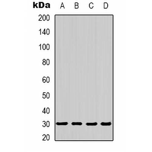 AMPK beta 2 Rabbit Polyclonal Antibody