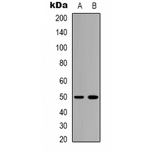 Bestrophin-2 Rabbit Polyclonal Antibody
