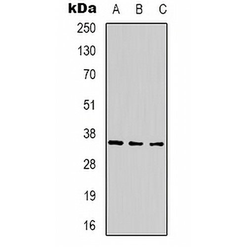 CABP2 Rabbit Polyclonal Antibody