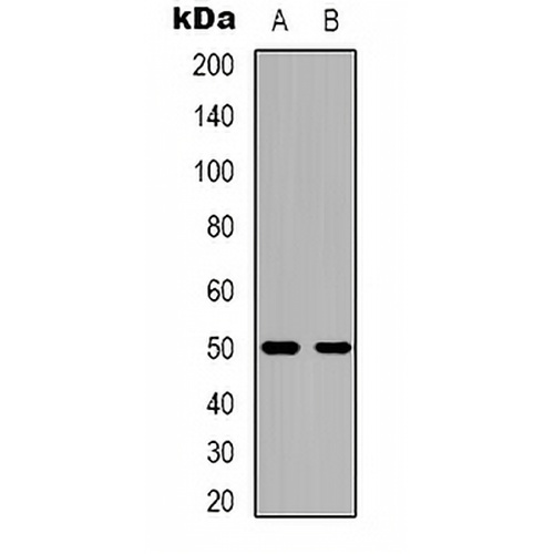 CACNB3 Rabbit Polyclonal Antibody