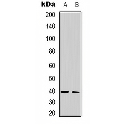 CALHM1 Rabbit Polyclonal Antibody
