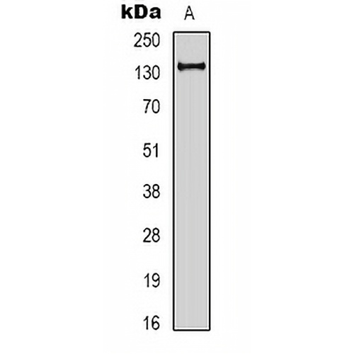 E Cadherin Rabbit Polyclonal Antibody