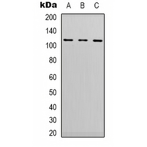 EPHA1 Rabbit Polyclonal Antibody