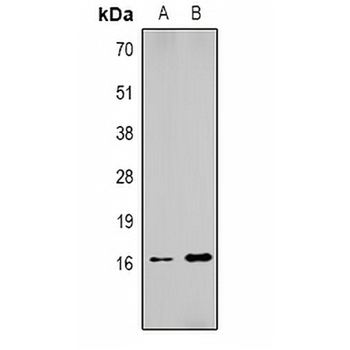 Histone H1 (DiMethyl-K25) Rabbit Polyclonal Antibody