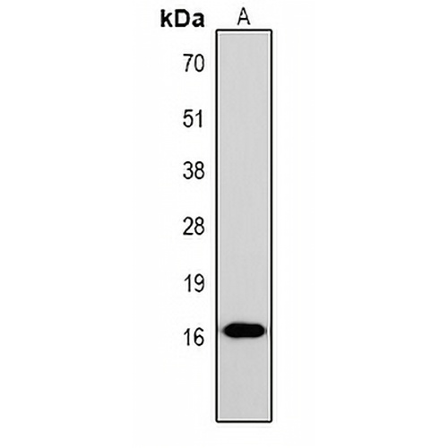 Histone H1 (Phospho-T17) Rabbit Polyclonal Antibody