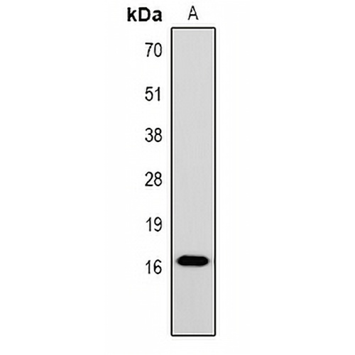 Histone H1 (TriMethyl-K25) Rabbit Polyclonal Antibody