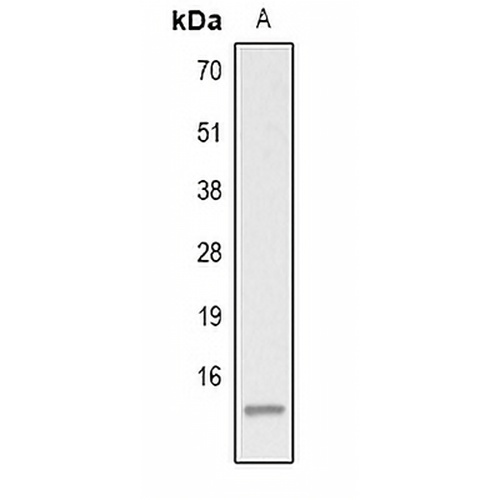 Histone H2A (Acetyl-K15) Rabbit Polyclonal Antibody