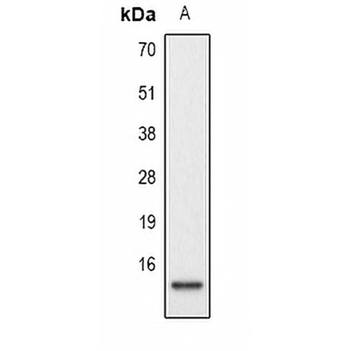 Histone H2A (Phospho-S129) Rabbit Polyclonal Antibody