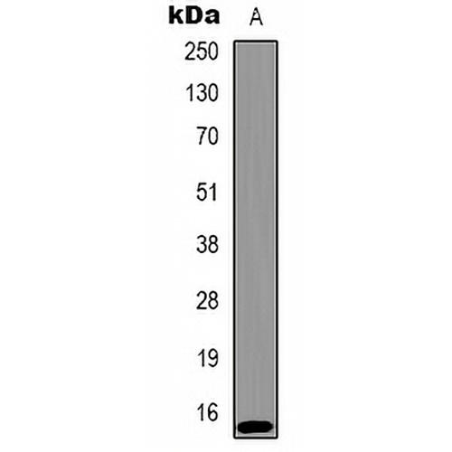 Histone H2A.X (Phospho-T120) Rabbit Polyclonal Antibody
